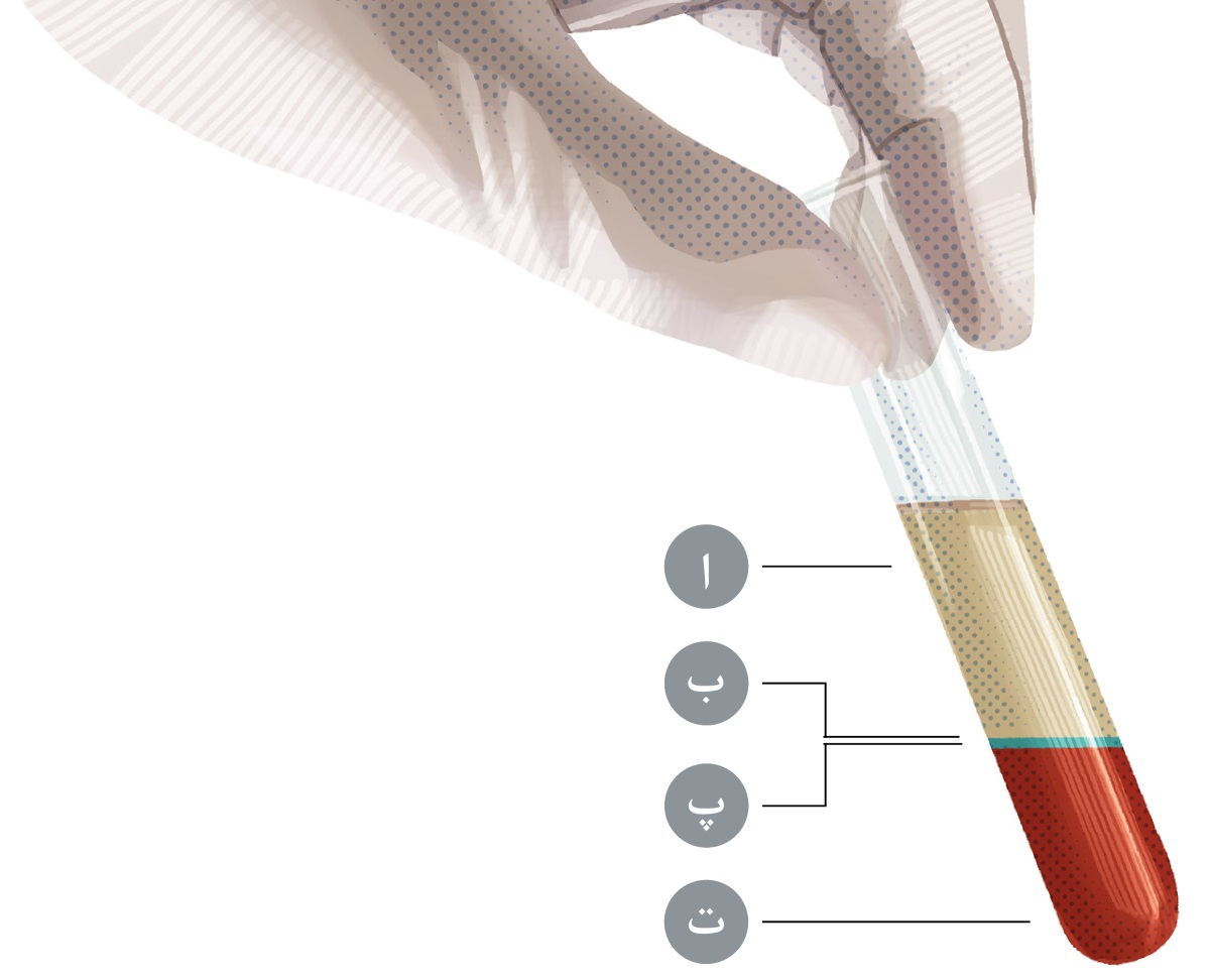 بۆڕی تاقیکردنە‌وە کە خوێنی تێدایە بۆ چوار پێکهاتە‌ی سە‌رە‌کی جیا دە‌کرێتە‌وە کە بە ناوە‌کانی ا،‏ ب،‏ پ و ت ناودە‌برێن.‏