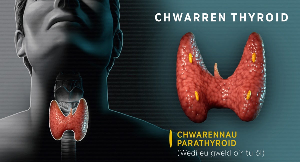 Collage: Diagramau sy’n dangos y chwarren thyroid. 1. Llun o’r gwddf yn dangos lle mae’r thyroid. 2. Llun o gefn y thyroid yn dangos y chwarennau parathyroid.