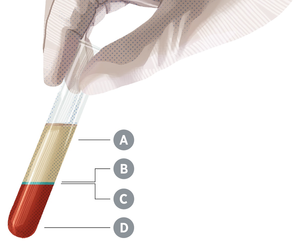 Maysa a test tube nga adda nagyanna a dara a nasinasina iti uppat a kangrunaan a pasetna, nga adda label-na nga A, B, C, ken D.