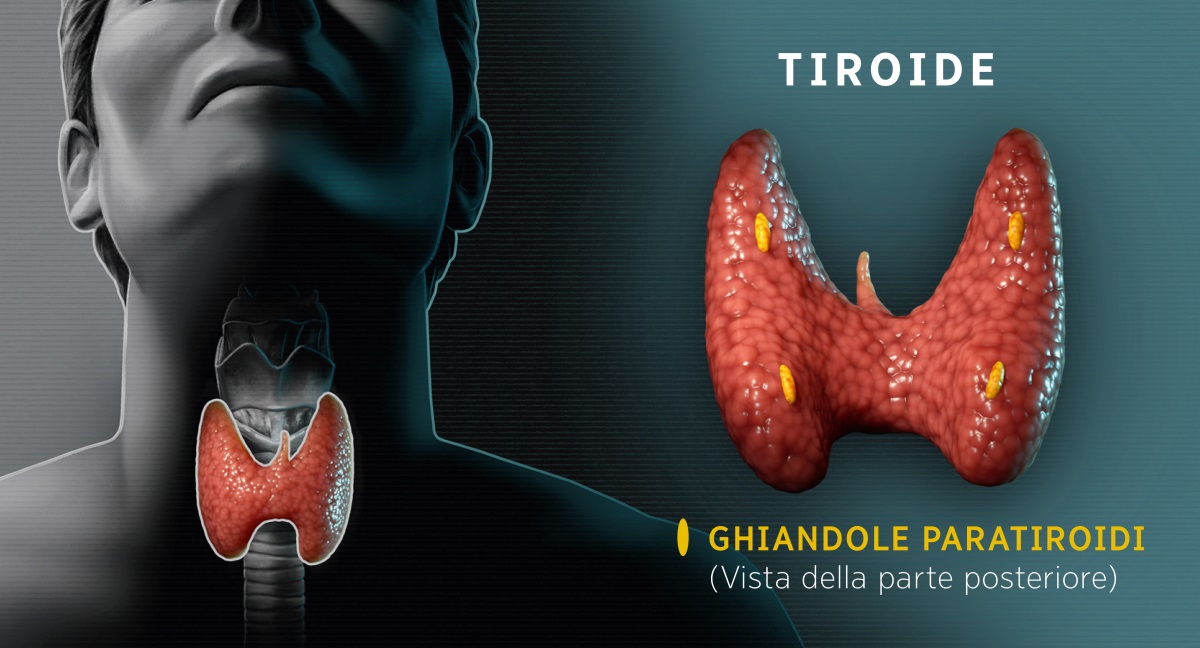 Collage: Immagini della tiroide. 1. Immagine frontale della tiroide che mostra la sua posizione all’interno del collo. 2. Immagine della parte posteriore della tiroide che mostra le ghiandole paratiroidi.