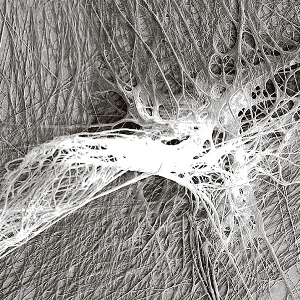 L-​iscaffolding disc taʼ brimba