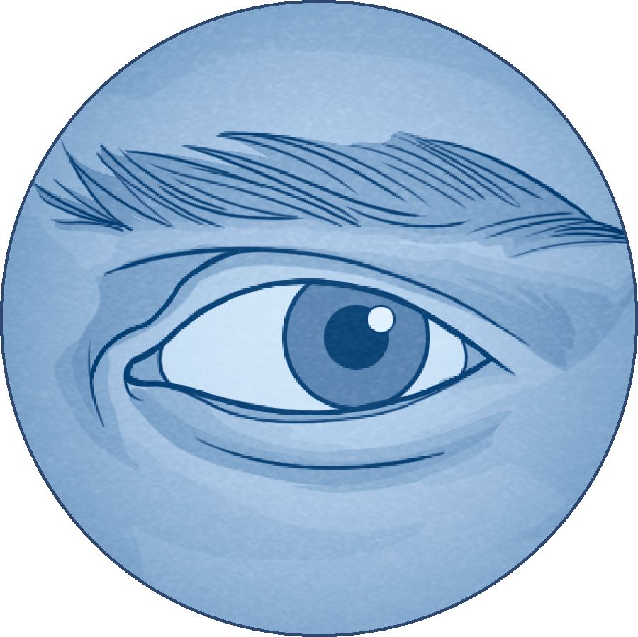 Wanfala eye