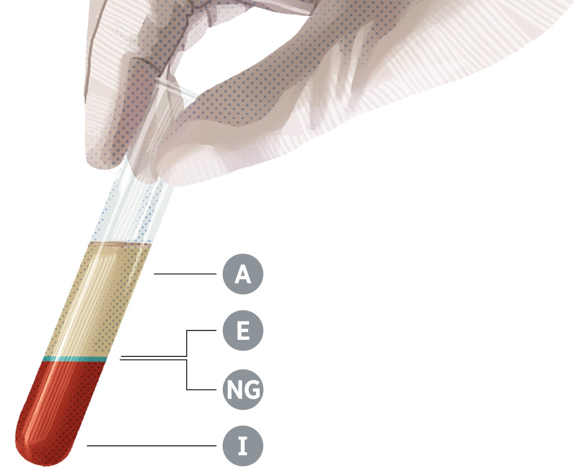 E test tube toto tei akatakakeia te au tuanga puapinga, tei akairoia A, E, NG, e te I.