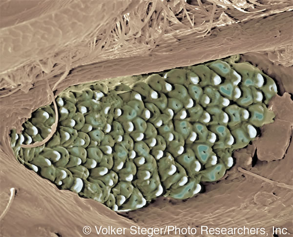 Receptory infračerveného žiarenia chrobáka Melanophila acuminata