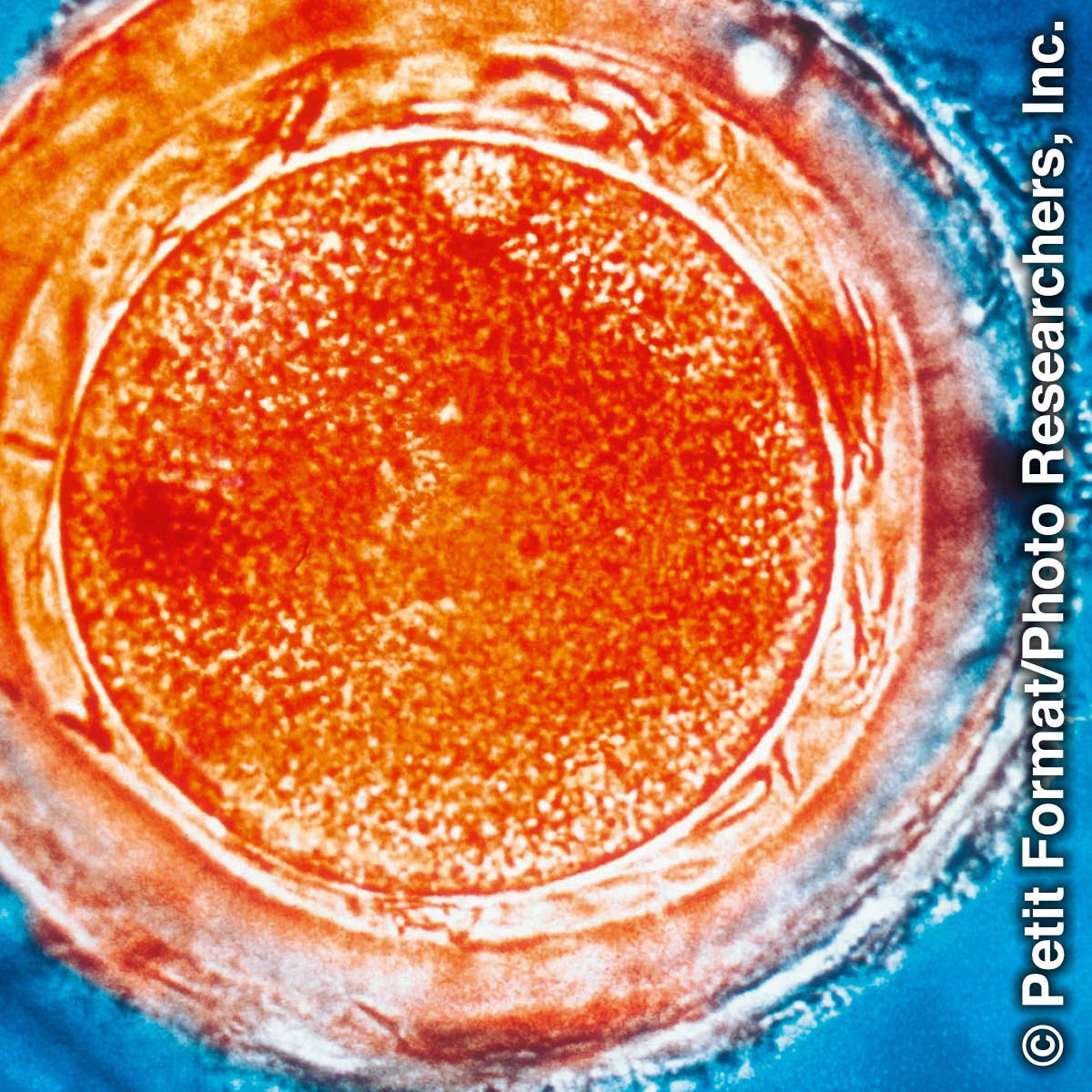 Oplodnené ľudské vajíčko