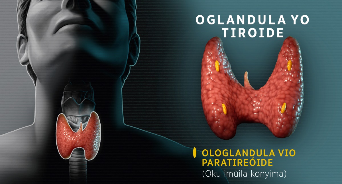 Ociluvialuvia: Ografiku yi lekisa oglandula yotiroide. 1. Onepa yimue yotiroide yi lekisa apa yi sangiwa posingo. 2. Elitalatu liotiroide li lekisa apa pa sangiwa olonglandula.